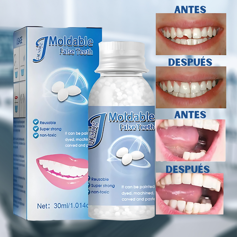 DentiFix: Resina en Esferas para Reparación Temporal de Dientes